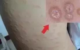拍一拍識別皮膚病——科技助力健康之路的新突破，科技助力皮膚健康，拍一拍識別皮膚病的新突破