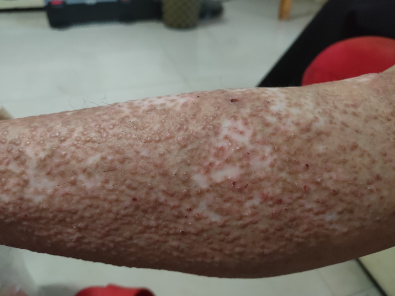 疾病能否治愈，全面解析與希望之光，疾病能否治愈，全面解析及展望希望之光