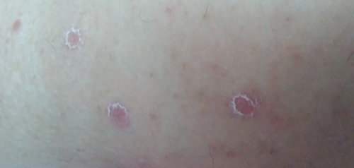 皮膚病對照圖，揭秘皮膚健康的秘密與真相，皮膚病對照圖，揭示皮膚健康真相的秘密鑰匙