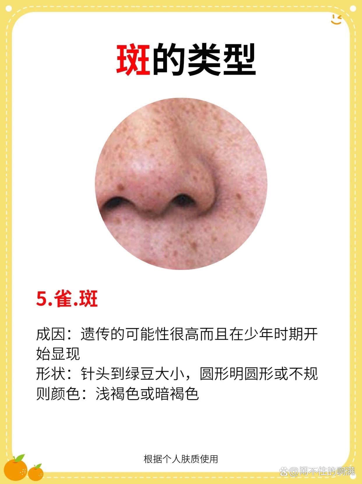 面部七種斑的圖片及其相關(guān)知識，面部七種斑的圖片與相關(guān)知識解析