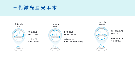近視眼手術(shù)最佳年齡和度數(shù)，全面解讀與指導(dǎo)，近視眼手術(shù)最佳年齡與度數(shù)解讀及指導(dǎo)