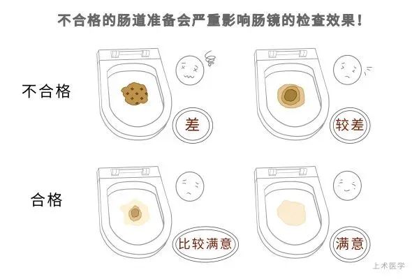 不想做腸鏡怎么查腸道——全面解析腸道健康檢查方法，腸道健康檢查方法，不做腸鏡如何查腸道？全面解析腸道健康檢查途徑
