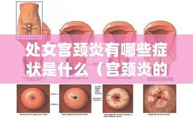 宮頸炎的癥狀解析，了解并預(yù)防宮頸炎的發(fā)生，宮頸炎癥狀解析與預(yù)防策略，全面認(rèn)識(shí)宮頸炎，守護(hù)女性健康
