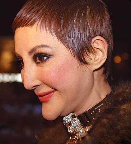 整容女星，美麗背后的故事與秘密，整容女星背后的故事與秘密，美麗傳奇的探尋