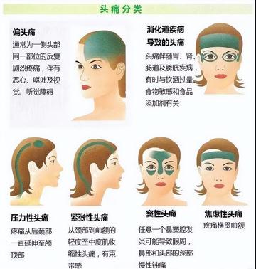 頭痛的快速緩解方法，實(shí)用建議與策略，頭痛快速緩解指南，實(shí)用建議與策略