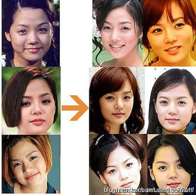 整容失敗的反思與應(yīng)對(duì)之道，整容失敗的教訓(xùn)與應(yīng)對(duì)策略