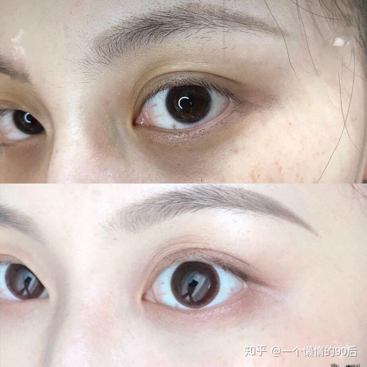 學(xué)生黨怎么去眼袋，實用方法與日常護理建議，學(xué)生黨去眼袋實用方法與日常護理建議，告別眼袋困擾！
