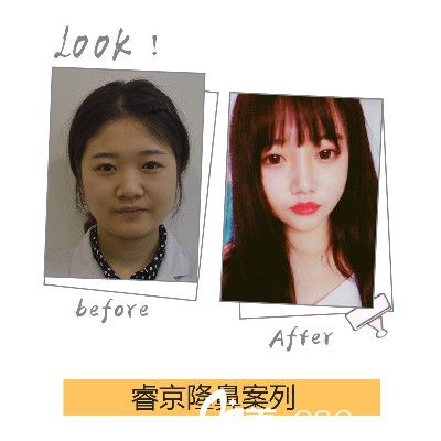 全臉整容費(fèi)用