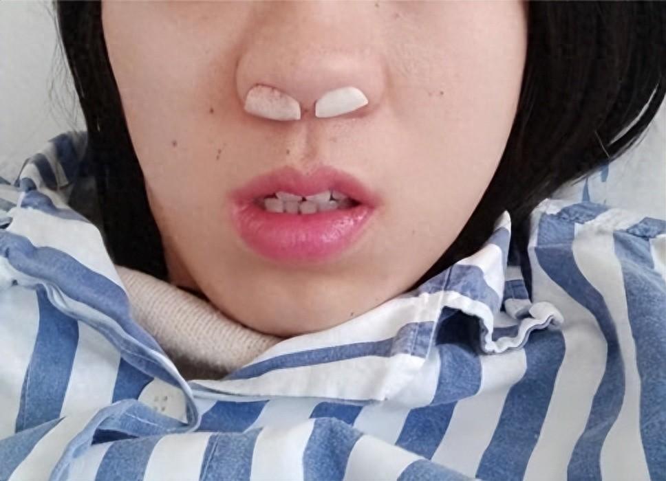 過敏最好的自愈方法，自然緩解與預(yù)防策略，過敏自愈之道，自然緩解與預(yù)防策略