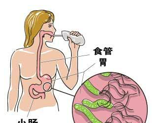 幽門螺旋桿菌會自愈嗎？解析幽門螺旋桿菌感染與防治策略，幽門螺旋桿菌感染，解析防治策略與自愈可能性探討