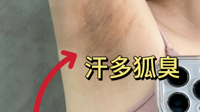 腋下異味與狐臭的判斷方法