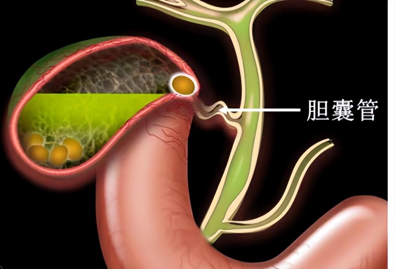急性腸胃炎的癥狀，了解并應對健康威脅，急性腸胃炎癥狀解析與應對策略