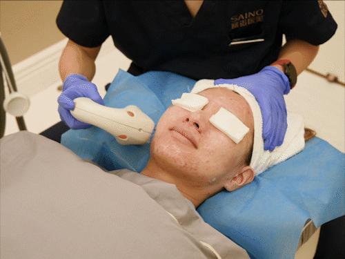 醫(yī)院做一次光子嫩膚多少錢(qián)？全面解析光子嫩膚費(fèi)用因素，醫(yī)院光子嫩膚費(fèi)用全解析，價(jià)格因素及大致費(fèi)用探討