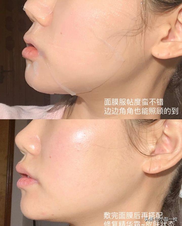 痘印能否恢復(fù)到正常皮膚，解析與策略，痘印解析與恢復(fù)策略，能否重返無瑕肌膚？