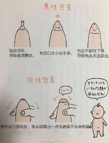 割包十個有九個后悔，知乎熱議背后的故事，知乎熱議背后的割包故事，多數人的后悔真相
