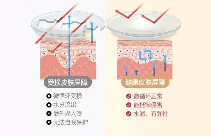 全面解析腳氣治療，如何根除腳氣，重拾健康雙腳？，全面解析腳氣治療，根除腳氣，重塑健康雙腳的方法？