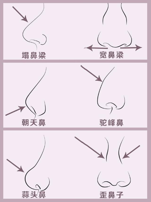 青春期怎樣讓鼻子變挺，青春期如何塑造挺拔的鼻子？