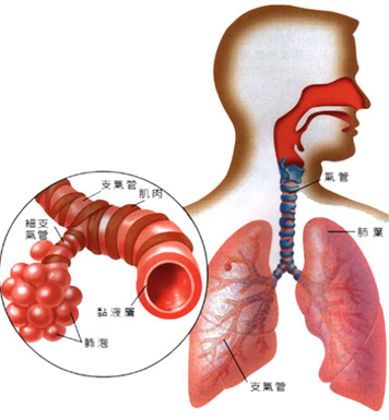 支氣管炎，了解、預(yù)防與治療，支氣管炎，全面解析、預(yù)防與治療方法