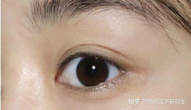 黑眼圈太重了太黑了怎么去掉——全方位解析黑眼圈成因與消除方法，全方位解析，黑眼圈成因及消除方法，告別熊貓眼！