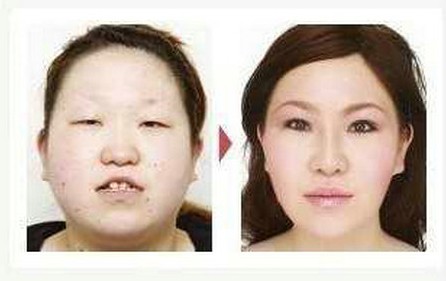整容前與整容后的對(duì)比照，深度探討外貌變化與個(gè)人認(rèn)知重塑，深度解析，整容前后對(duì)比照與外貌變化重塑個(gè)人認(rèn)知之旅