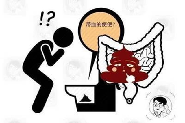 腸癌患者大便狀況解析，了解癥狀，預防勝于治療，腸癌患者大便狀況解析，預防勝于治療，了解癥狀是關鍵