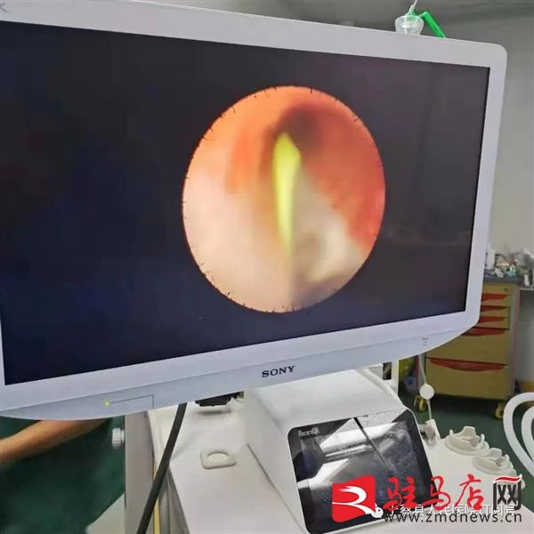 激光碎石費(fèi)用詳解，究竟需要多少錢？，激光碎石費(fèi)用全面解析，究竟需要多少費(fèi)用？