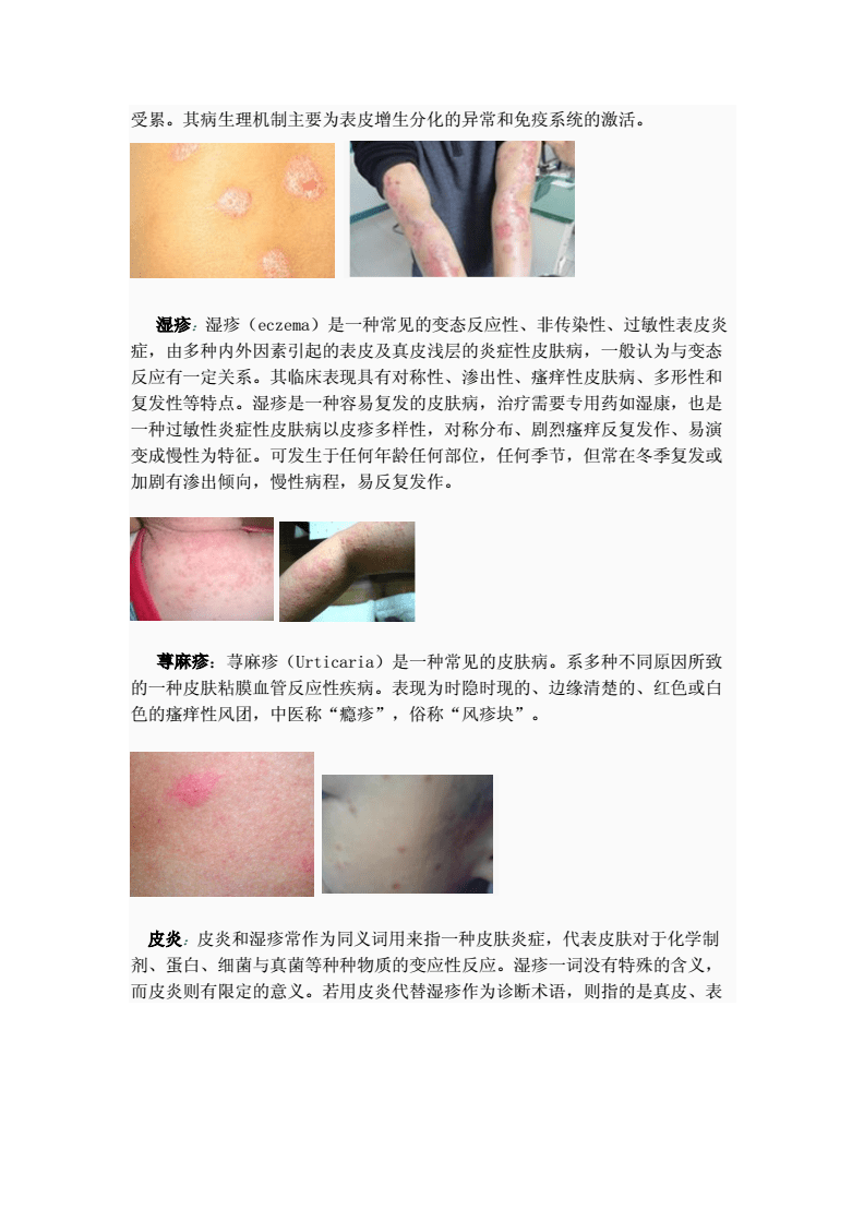 皮膚病對照大全，癥狀、原因與治療方法，皮膚病癥狀、原因及治療方法對照大全