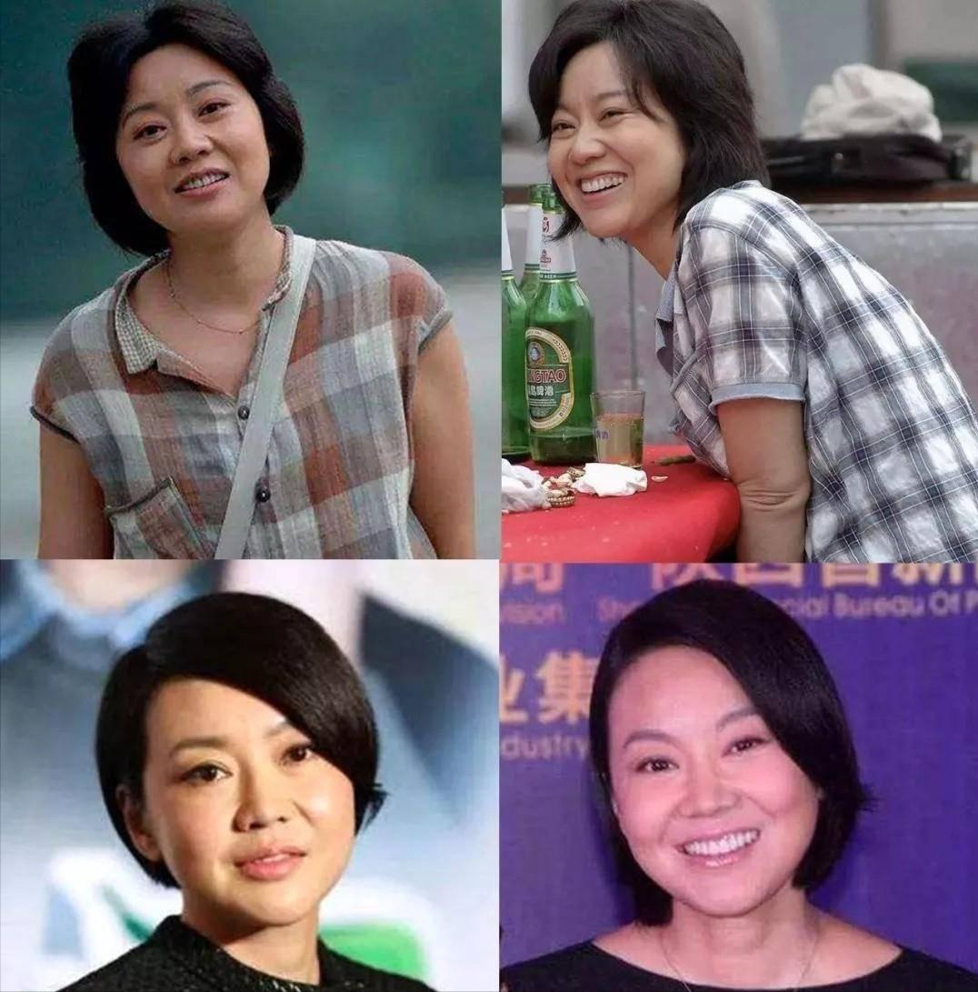 整容可以整成明星臉嗎？深度解析與探討，深度解析，整容能否整出明星臉？