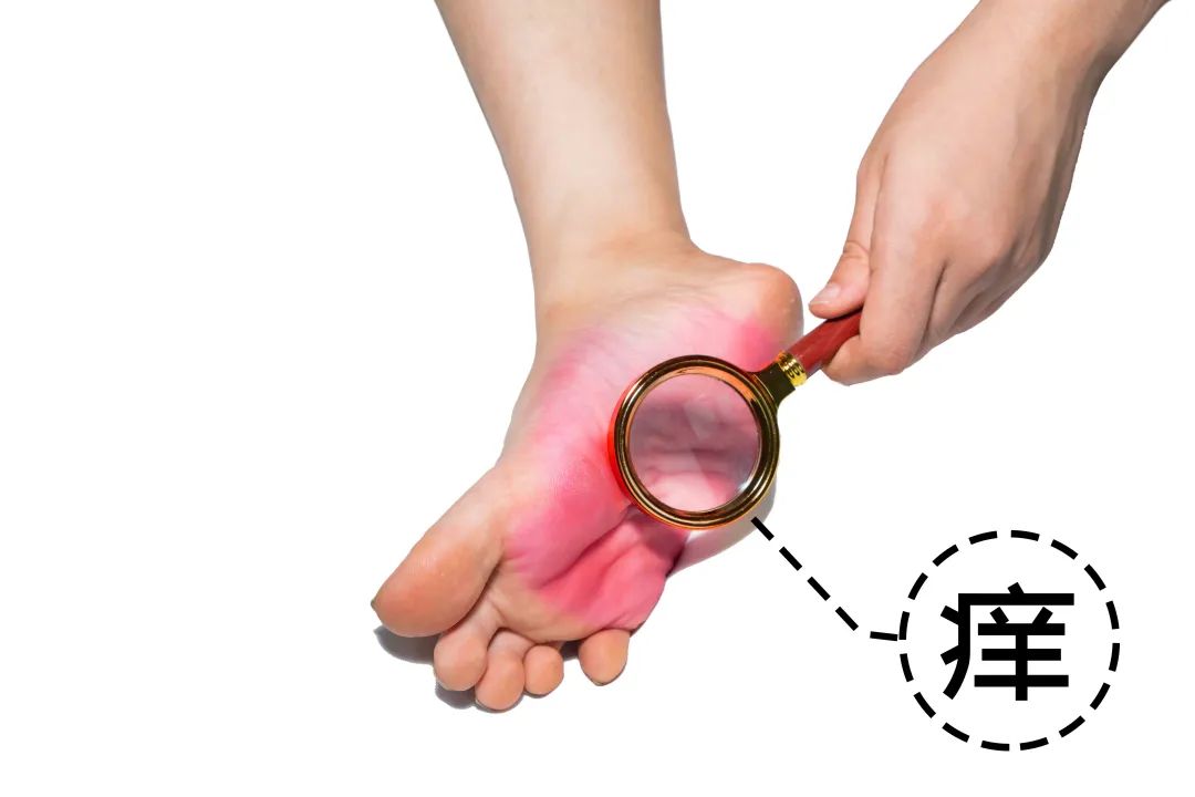 霉菌性陰炎最怕的克星，了解、預(yù)防與治療，霉菌性陰炎的克星，全面解析預(yù)防與治療策略