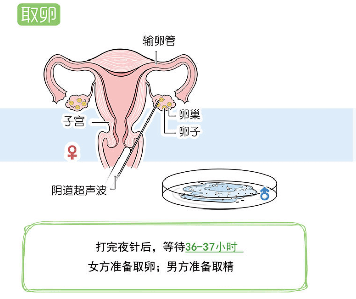 試管嬰兒的全部流程詳解，試管嬰兒全程詳解指南