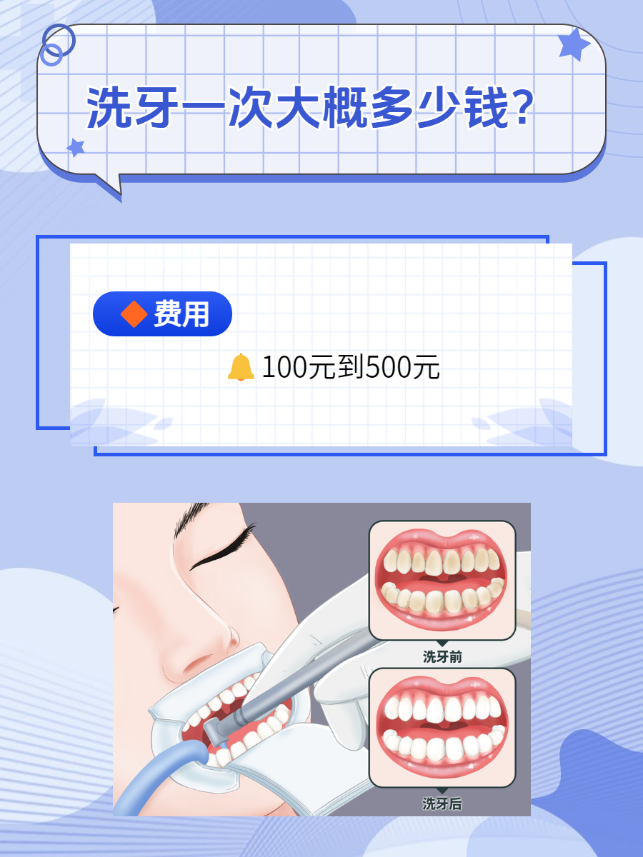 洗牙多少錢——全面解析洗牙費(fèi)用因素，全面解析洗牙費(fèi)用因素，洗牙價(jià)格究竟多少？