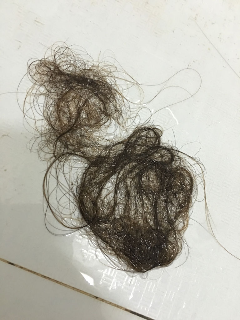 女性突然開始大量掉頭發(fā)的原因解析，女性大量掉頭發(fā)的原因解析與應對之道