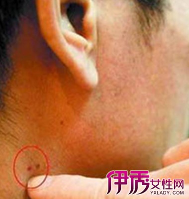 男人得艾滋6個(gè)前兆及其重要性，男人感染艾滋的六個(gè)前兆及其重要性解析