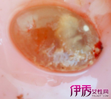 懷孕多久可以藥物流產(chǎn)——全面解析藥物流產(chǎn)時機與注意事項，懷孕早期如何進(jìn)行藥物流產(chǎn)？全面指南解析時機與注意事項