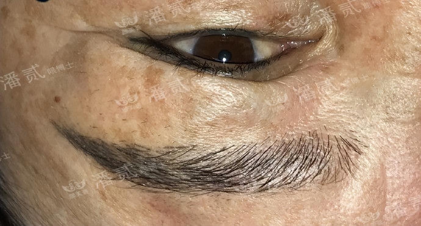 雙眼皮修復，尋找最佳修復地點，重塑迷人魅力雙眼，雙眼皮修復重塑美麗雙眼，尋找最佳修復地點，展現迷人魅力