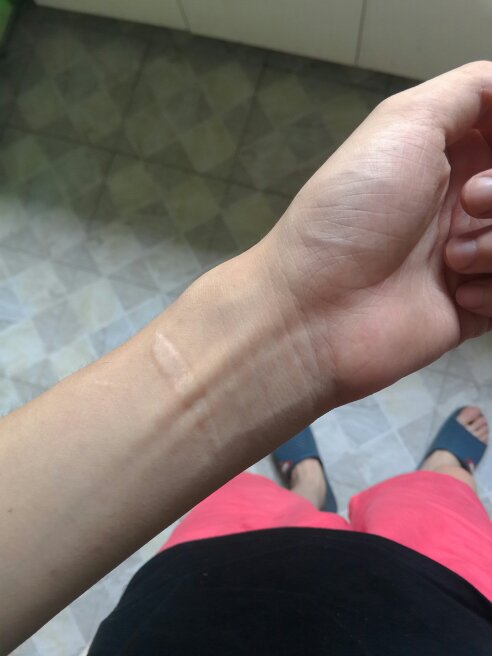 當(dāng)兵體檢為何要進(jìn)行翻龜頭檢查，全面解析其必要性與重要性，當(dāng)兵體檢中的翻龜頭檢查，必要性與重要性解析