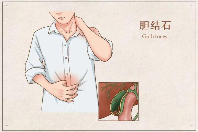 左下腹部隱痛，警惕潛在的健康風(fēng)險，左下腹部隱痛，潛在健康風(fēng)險的警示信號