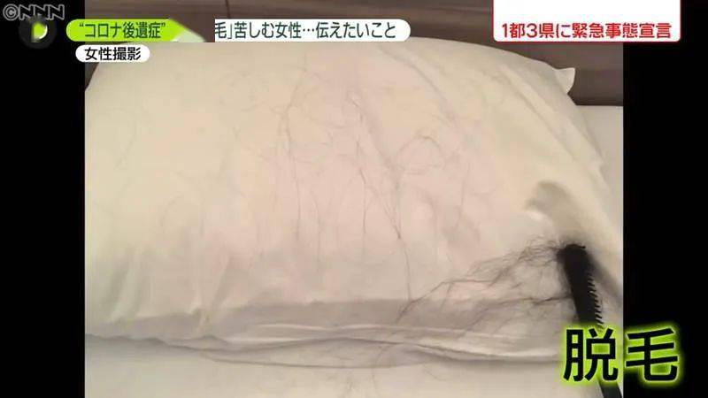 頭發(fā)輕輕一抓掉10多根，原因解析與應(yīng)對(duì)策略，頭發(fā)大量掉落原因解析及應(yīng)對(duì)方法，輕松一抓掉10多根怎么辦？