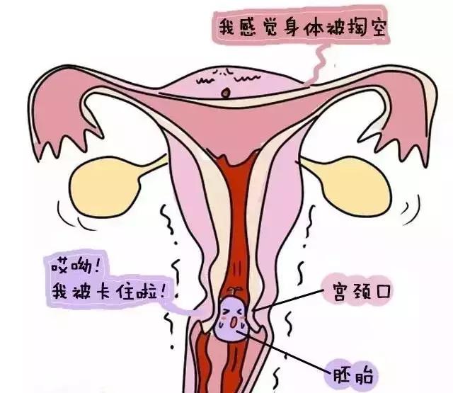 詳解攻略