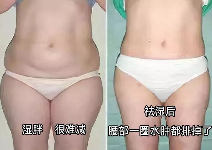 一招排出體內(nèi)10年濕熱毒——全面解析濕熱毒的成因與解決方案，全面解析濕熱毒的成因與解決方案，一招排除體內(nèi)十年濕熱毒
