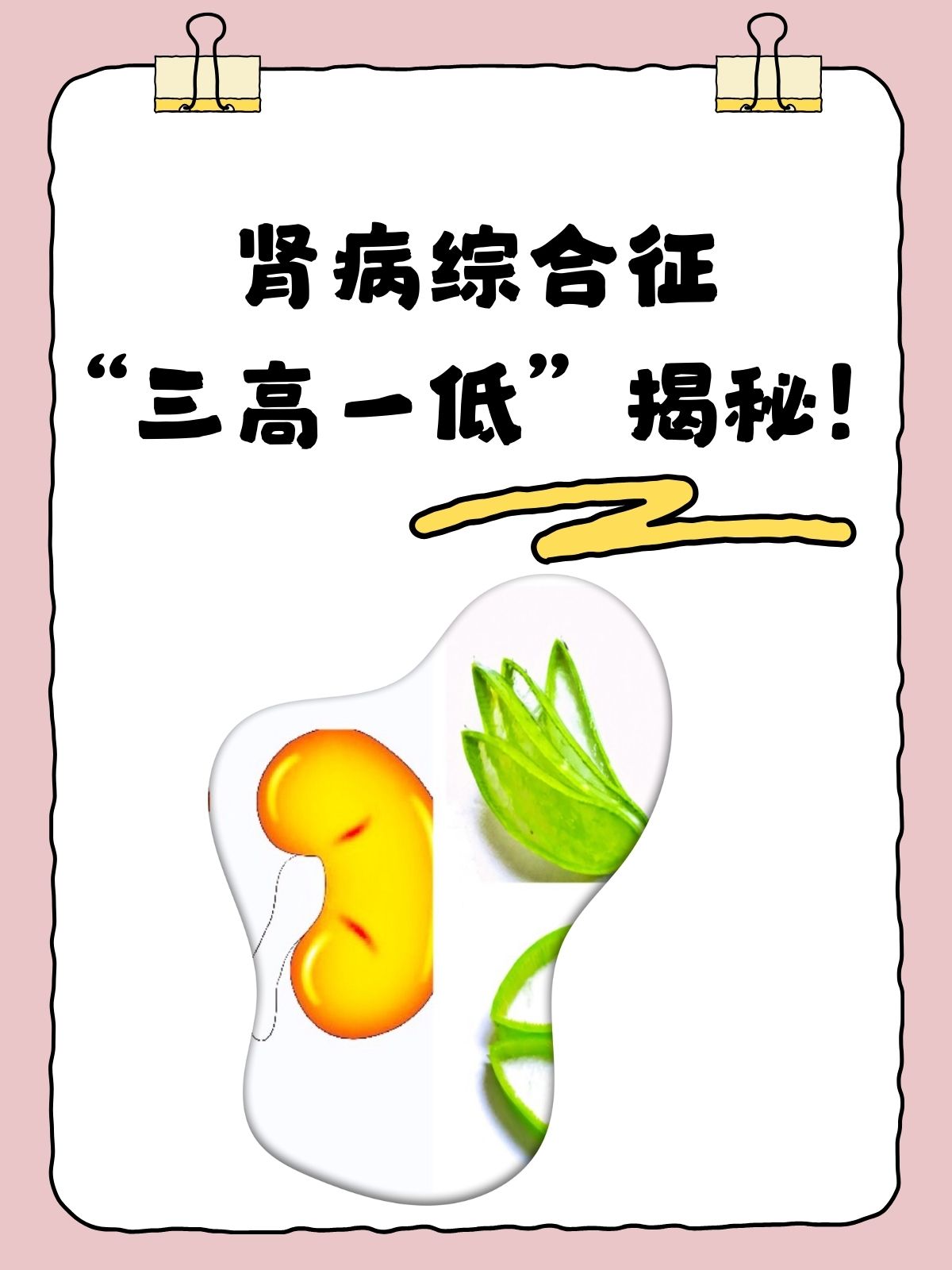 腎病綜合征，深入了解與應(yīng)對之道，腎病綜合征，全面解析與應(yīng)對策略
