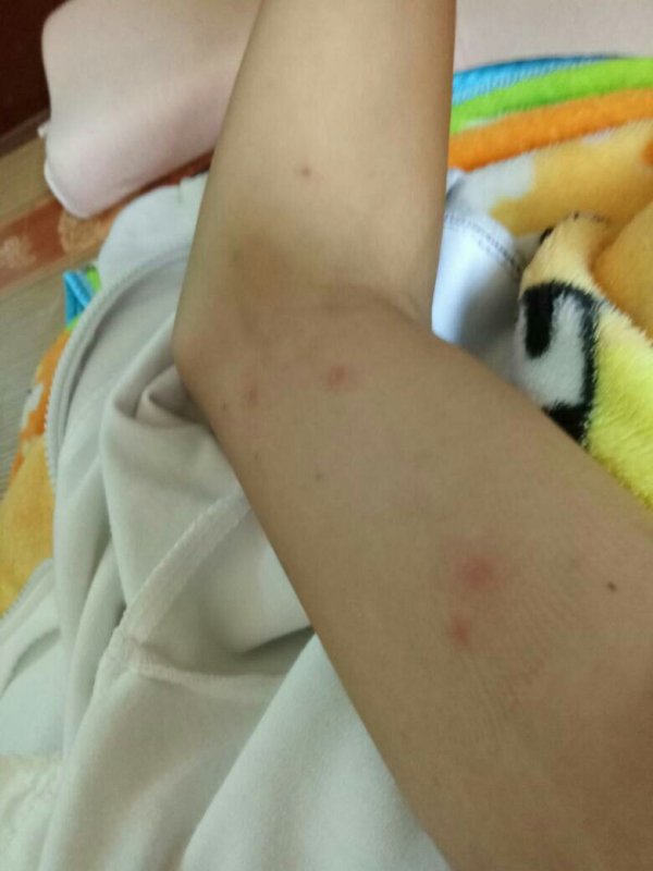 睪丸皮癢癢越抓越癢的原因及解決方法，睪丸皮癢癢，越抓越癢的原因與解決方法探討