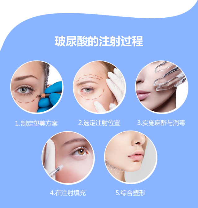 玻尿酸，美容秘籍中的秘密武器，玻尿酸，美容秘籍的核心秘密武器