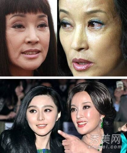 明星整容后遺癥陸續(xù)出現(xiàn)，如何科學看待與處理，明星整容后遺癥頻發(fā)，科學看待與處理的重要性
