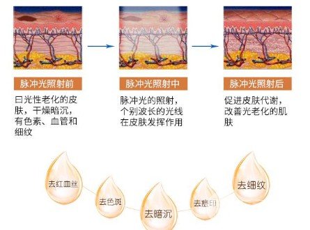 激光嫩膚美白一般多少錢，全面解析費(fèi)用因素與選擇策略，激光嫩膚美白費(fèi)用全解析，成本因素與選擇策略指南