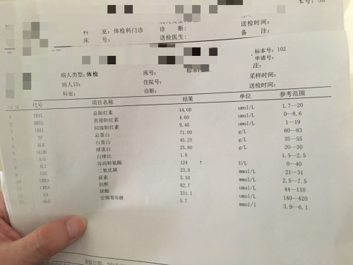 谷丙轉(zhuǎn)氨酶偏高至150，我才24歲，如何面對這一健康挑戰(zhàn)？，谷丙轉(zhuǎn)氨酶偏高至150，年輕時的健康挑戰(zhàn)如何應(yīng)對？