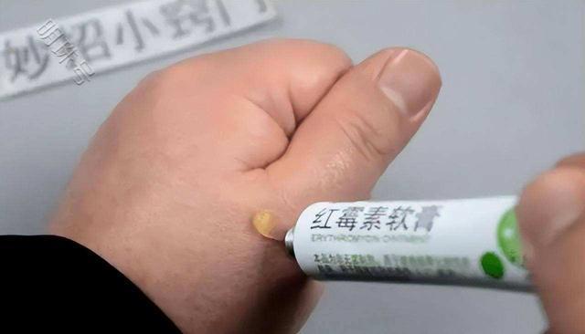 紅霉素軟膏，了解它的利與弊，避免誤解與濫用，紅霉素軟膏，利弊解析，避免誤解與濫用指南