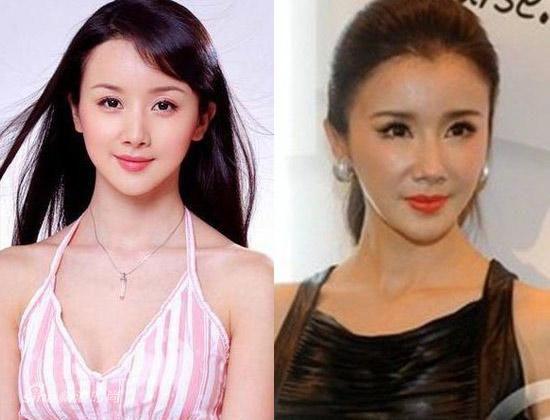 韓國明星整容失敗案例，深度解析與啟示，韓國明星整容失敗案例深度剖析，反思與啟示