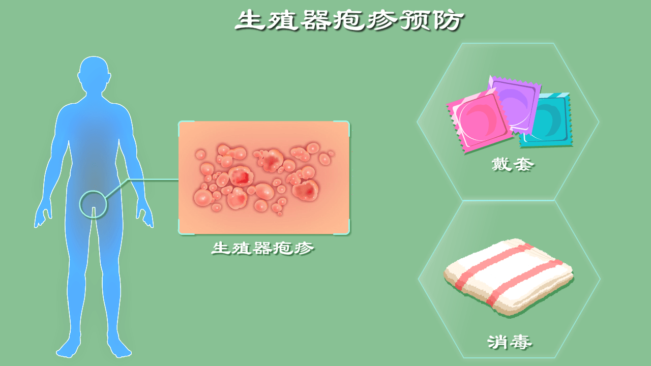 關(guān)于生殖系統(tǒng)器皰疹的根治方法，生殖系統(tǒng)器皰疹的根治方法探討