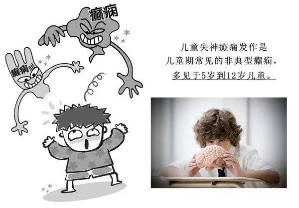關(guān)于癲瘋病一般在幾歲開(kāi)始發(fā)的探討，癲瘋病一般在何時(shí)開(kāi)始發(fā)病的探討